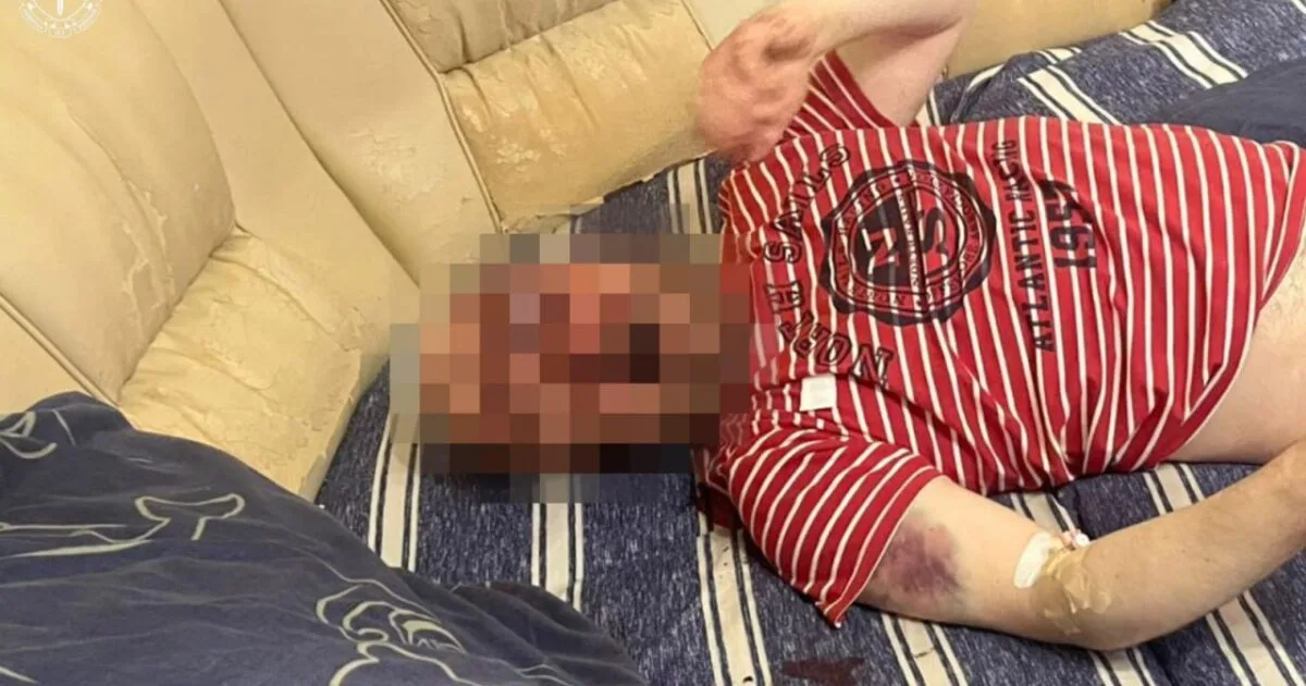 У Львові 23-річний львів’янин через ревнощі побив сусіда