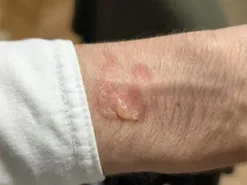 Власники Samsung Galaxy Watch скаржаться на опіки після носіння годинника