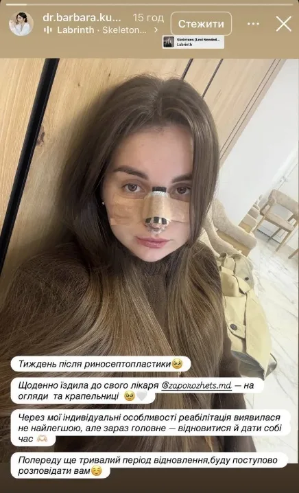 Донька Скрябіна зробила собі пластику обличчя