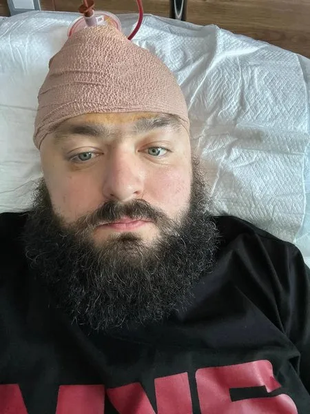 Кровоизлияние в мозг Вени