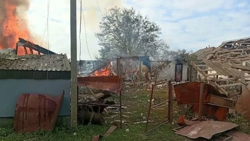10-річний хлопець отримав опіки понад 40% тіла внаслідок ворожого обстрілу: як допомогти родині з Чернігівщини (Фото)