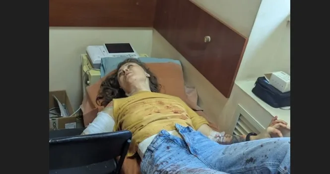 Під час удару по ДніпроГЕСу постраждала запорізька майстриня-вишивальниця Наталія Матвєєва, — ФОТО, ВІДЕО