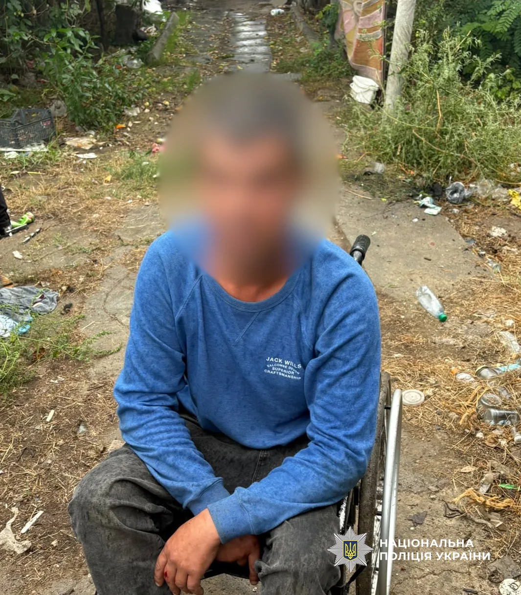 На Одещині чоловіку загрожує до 8 років за гратами за побиття собаки сокирою