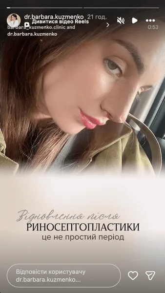 Барбара Кузьменко сделала риносептопластику